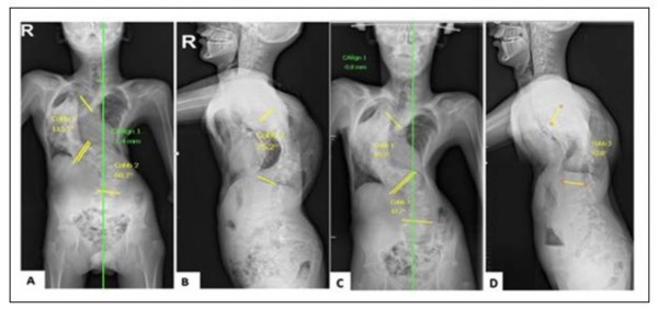 Trunk Appearance Perception Scale (TAPS).