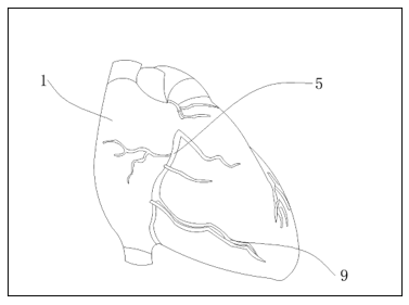 A diagram of a heart

Description automatically generated