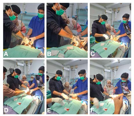 A collage of several people performing surgery

AI-generated content may be incorrect.