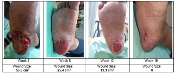 A comparison of a person's foot

AI-generated content may be incorrect.