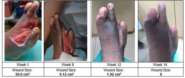 A close-up of a person's foot

AI-generated content may be incorrect.