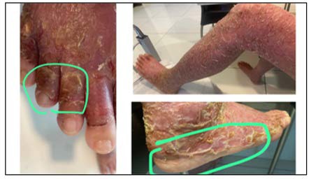 A close-up of a person's leg

AI-generated content may be incorrect.