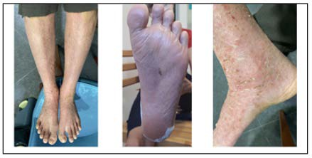 A collage of different images of a person's foot

AI-generated content may be incorrect.