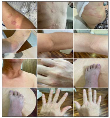 A collage of different images of a person's arm and hand

AI-generated content may be incorrect.