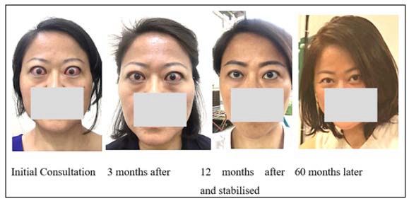 A collage of women with different facial features

AI-generated content may be incorrect.