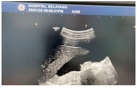 A close-up of a ultrasound

AI-generated content may be incorrect.