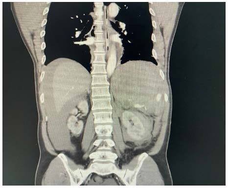 A close-up of an x-ray of a person's body

AI-generated content may be incorrect.