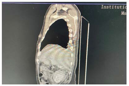 A close-up of an x-ray

AI-generated content may be incorrect.