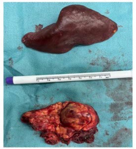 A thermometer and a liver

AI-generated content may be incorrect.