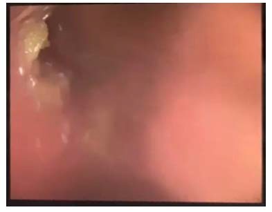 Close-up of a person's mouth

AI-generated content may be incorrect.