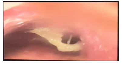 A close-up of a tooth

AI-generated content may be incorrect.
