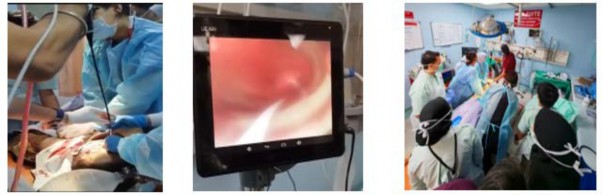 A screen with a picture of a person's mouth

AI-generated content may be incorrect.