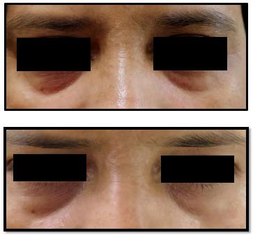 Close-up of a person's eyes

AI-generated content may be incorrect.